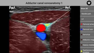 AnSo Anaesthesia Sonoanatomy header